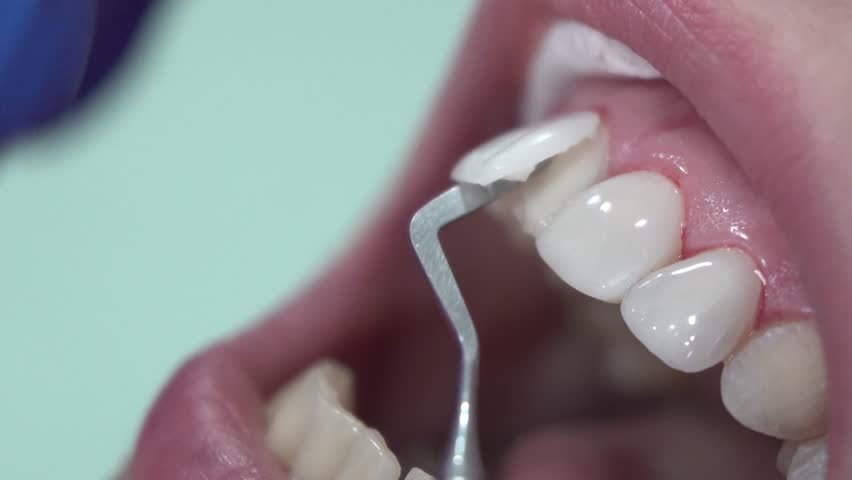 Overview of Dental